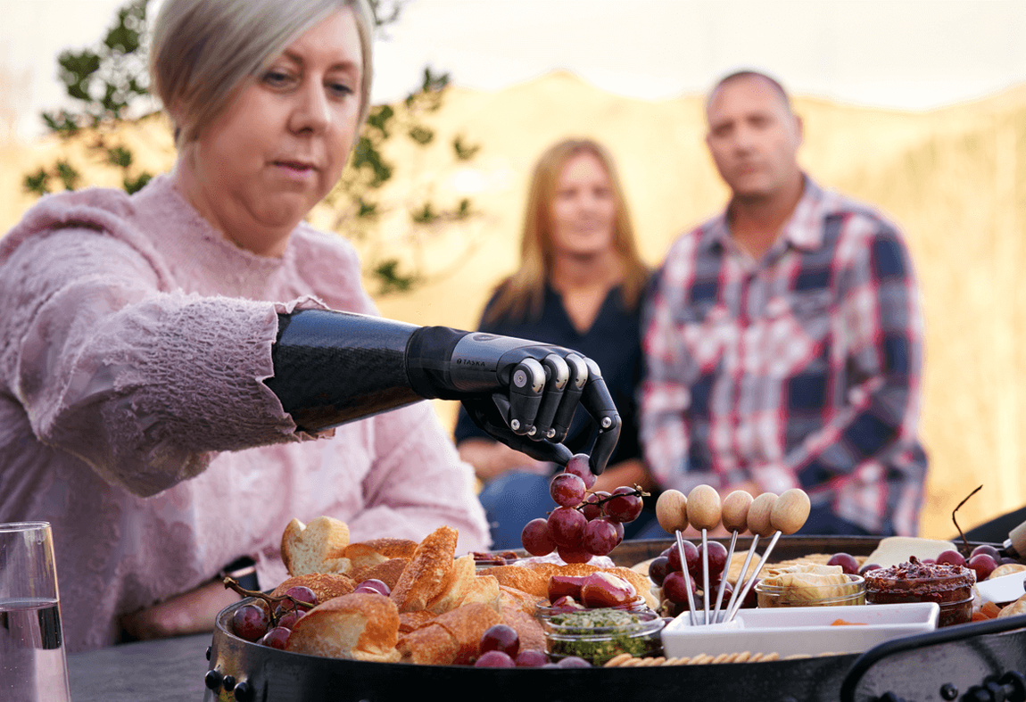 Can you feel things with a prosthetic hand_header